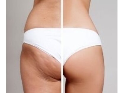 カノン(Kanon.)の写真