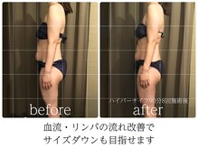 ライフチャージ(Life Charge)/巡り改善→サイズダウンに効果的