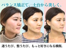 ナチュラルビューティーフェイス 横浜(NBF)/むくみ・たるみ改善！歪み矯正