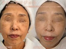 レイネ(REINE)の雰囲気（「日常に潤いが♪」ハリ透明感*エレクトロポレーション導入◎）