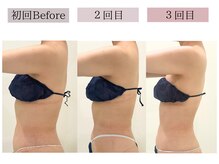 フロリール アザブジュウバン(FlorirAzabujuban)/痩身/脂肪燃焼/くびれ美人