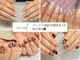 ウニネイル(uni nail)の写真