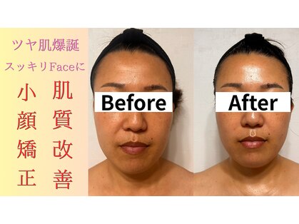 カエラ(Kaela)の写真