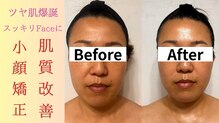 カエラ(Kaela)