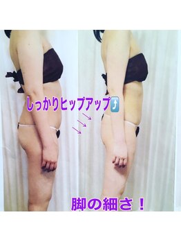 ボディエステティック アクアオーラ 富山店/美尻美脚