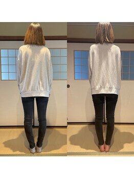 リテラ(Retera)/O脚ケア