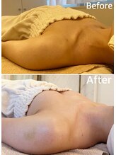 ラビス(RAVIS)/20代　寝た状態でもふっくら♪