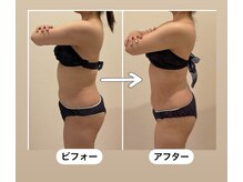 TMサロン 赤坂/なんと3回目で？お腹が、、、