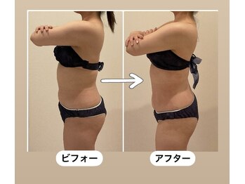 TMサロン 赤坂/なんと3回目で？お腹が、、、