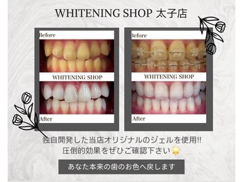 ホワイトニングショップ 太子店/ホワイトニング初回がお得！