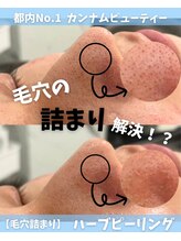 カンナムビューティー 新宿 代々木 肌のお悩み 徹底改善♪
