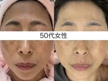 サクラ 伊勢原店(SAKURA)/エステ以上の効果を専門店の強み