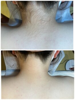 リサ(LiSA)/Q.効果はどのくらいで感じれる?