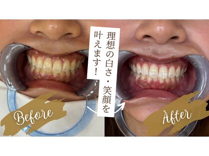 スマイルプライベートビューティサロン(Smile)の写真
