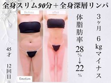 マシンと手技で全身を薄く＆痩身効果2倍◎ぽっちゃり体型を改善