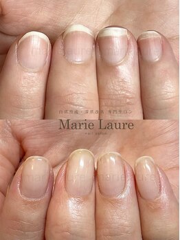 マリーロール 天王寺店(Marie Laure)/深爪矯正/自爪育成/ネイルケア