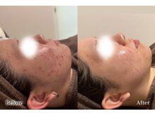 アネル 宮古島店(anel)/