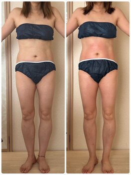 リノ(Lino)/全身6回でここまで変化