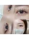 ラッシュソア(LASH Soa.)の写真/上下マツエクで中顔面短縮効果