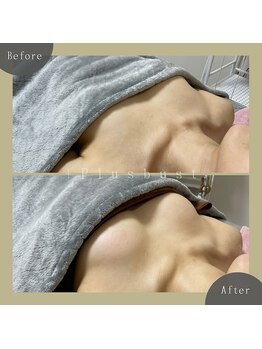 プラス バスト(+Plusバスト)/お客様BeforeAfterお写真
