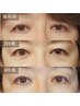 【40才以上のたるみケア】額シワ予防！まぶた、あご下のたるみ改善45分