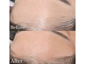 ブラン 阪急千里中央ビル店(Blanc)/つるんと美肌★おでこ+眉毛WAX