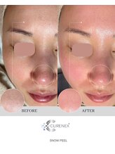 アンド ジョイ(&JOY)/新メニュー☆艶玉肌スノーピール