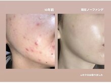 ラティア(Ratia)の雰囲気（元々肌荒れに悩んでたスタッフに皆様のお悩みをお聞かせ下さい☆）