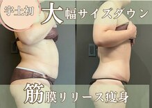 ステラ(Stella)