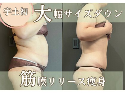 ステラ(Stella)の写真