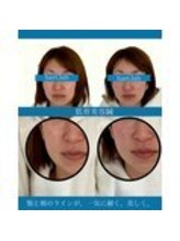 ハリラボ 仙台上杉店(hari Lab.)/【お客様の声】