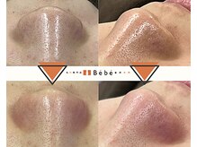 ベベ 大阪中央店(Be’be’)の雰囲気（ビフォーアフター）