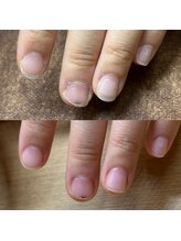 リリ(lili)/自爪育成＋クリアジェル