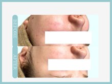 アコガレコガオ 秋田店/