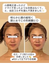 パル コルギサロン(Pal. Korugi salon)/コルギビフォーアフター