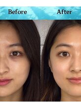 クロシェット(Clochette)/