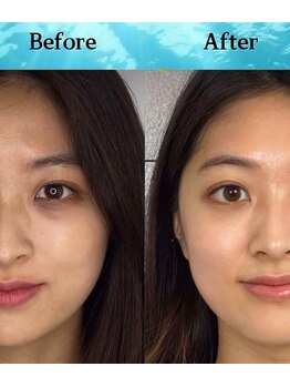 クロシェット(Clochette)/