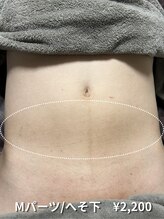 カナウ(KANAU)/【Mパーツ/脱毛】へそ下