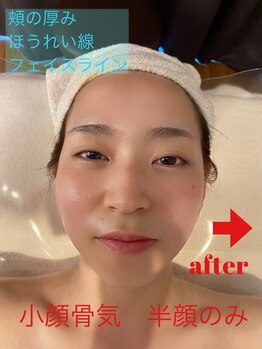 クレール 新松戸(Claire)/スッキリ爽快！小顔コルギ