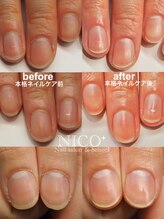 ニコプラス(NICO+)/ジェルネイルができない方向け
