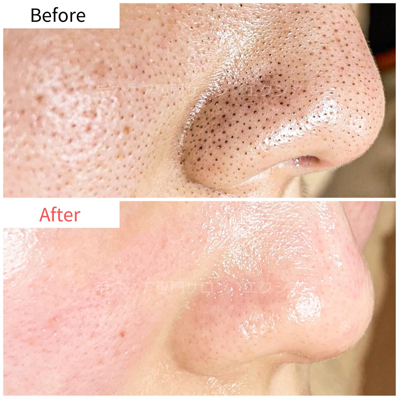 エクシア(Excia)｜ホットペッパービューティー