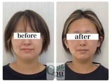 キュープ 名張店(Qpu)/オイルコース4回での変化