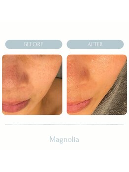 マグノリア(Magnolia)/