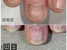 グレースレディ 神戸北店/