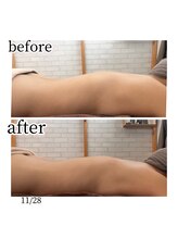 メルシートータルビューティー(MERCI)/