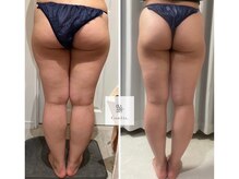 マシェリ 吉祥寺(Macherie)/脂肪燃焼　10ml導入