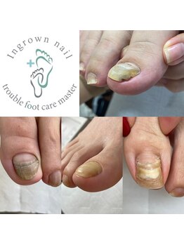 どんな爪もご相談ください！