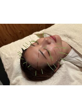 小顔になりたい