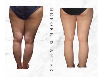 ルチノ(LUTINO)/理想のボディラインへと導きます