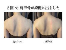 ナチュラーレ 天王寺店(Naturale)/痩身リンパマッサージ二の腕美脚